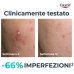 EUCERIN, DERMOPURE CLINICAL - SIERO VISO  TRIPLA AZIONE